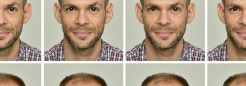 Homme avec différentes calvities et styles de barbe.